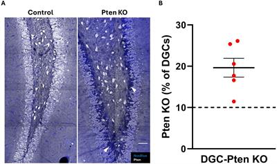 Somatostatin interneuron fate-mapping and structure in a Pten knockout model of epilepsy